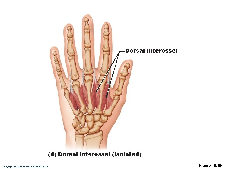 Dorsal interossei (d) Dorsal interossei (isolated) Copyright © 2010 Pearson Education, Inc. Figure 10. Dorsal interossei (d) Dorsal interossei (isolated) Copyright © 2010 Pearson Education, Inc. Figure 10.