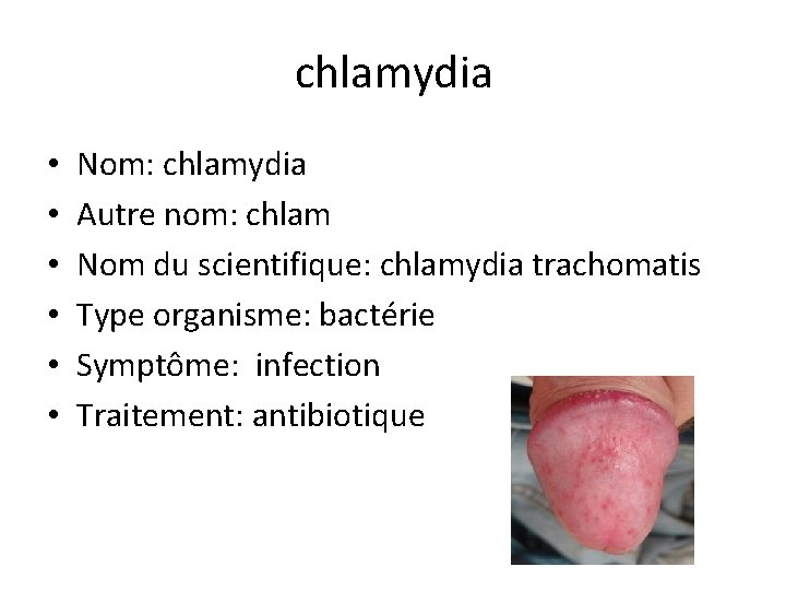 chlamydia • • • Nom: chlamydia Autre nom: chlam Nom du scientifique: chlamydia trachomatis