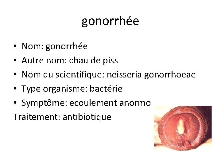 gonorrhée • Nom: gonorrhée • Autre nom: chau de piss • Nom du scientifique: