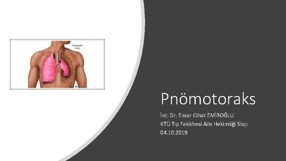 Pnömotoraks İnt. Dr. Ensar Cihat EMİROĞLU KTÜ Tıp Fakültesi Aile Hekimliği Stajı 04. 10. Pnömotoraks İnt. Dr. Ensar Cihat EMİROĞLU KTÜ Tıp Fakültesi Aile Hekimliği Stajı 04. 10.