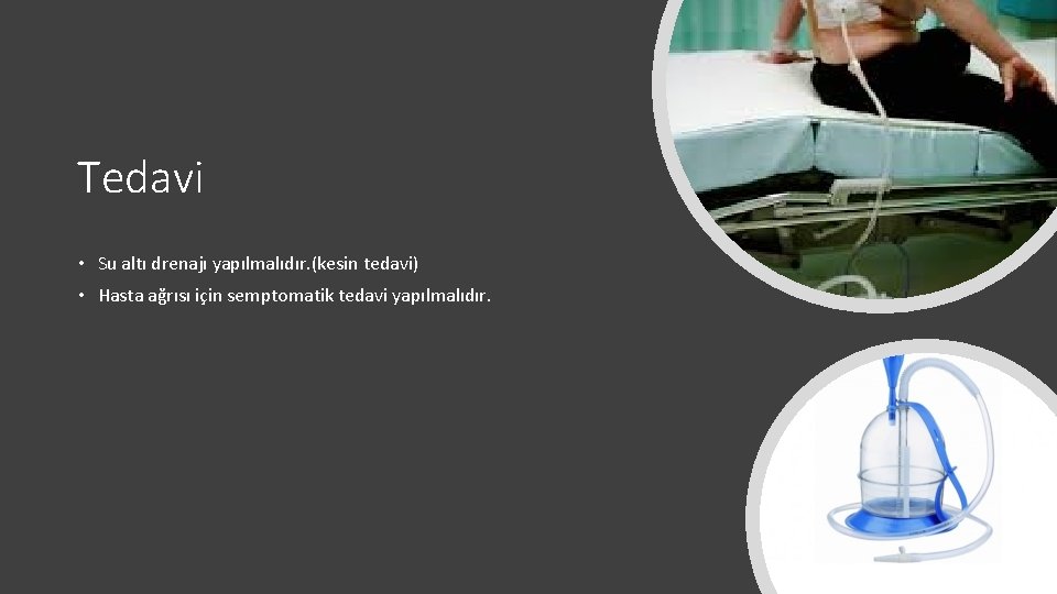 Tedavi • Su altı drenajı yapılmalıdır. (kesin tedavi) • Hasta ağrısı için semptomatik tedavi Tedavi • Su altı drenajı yapılmalıdır. (kesin tedavi) • Hasta ağrısı için semptomatik tedavi