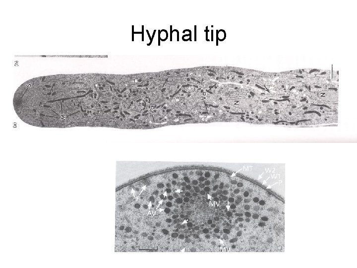 Hyphal tip 