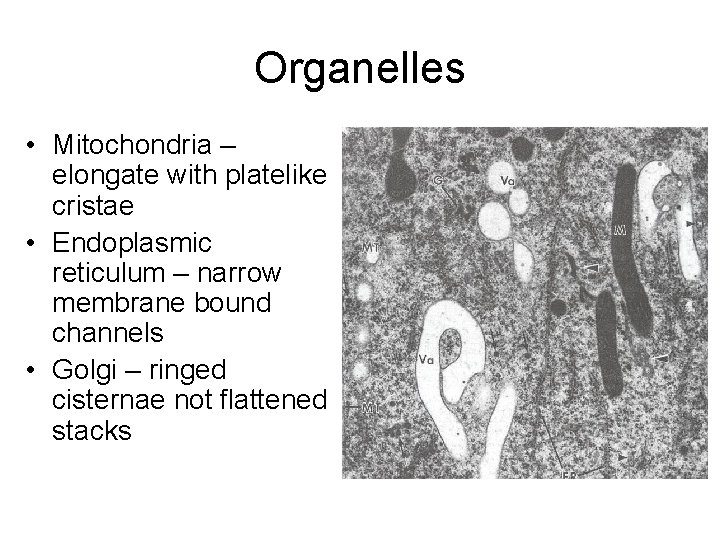 Organelles • Mitochondria – elongate with platelike cristae • Endoplasmic reticulum – narrow membrane