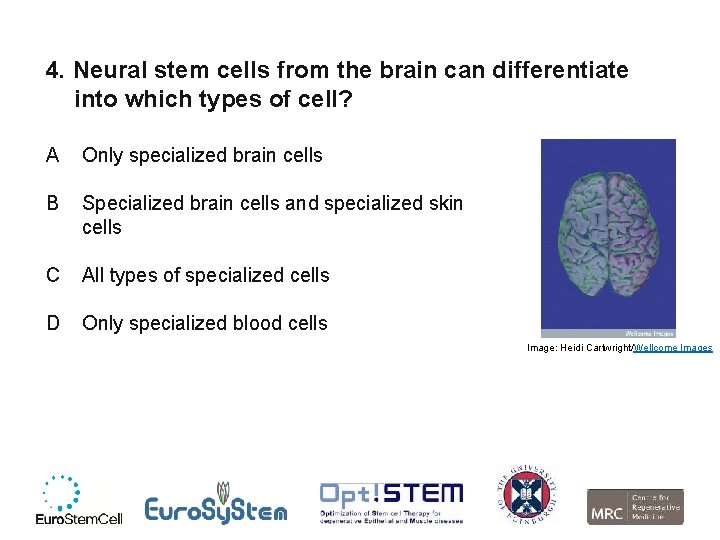 4. Neural stem cells from the brain can differentiate into which types of cell?