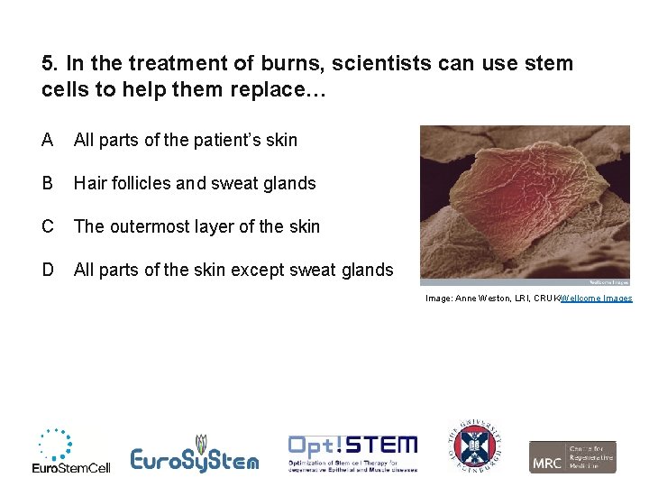 5. In the treatment of burns, scientists can use stem cells to help them