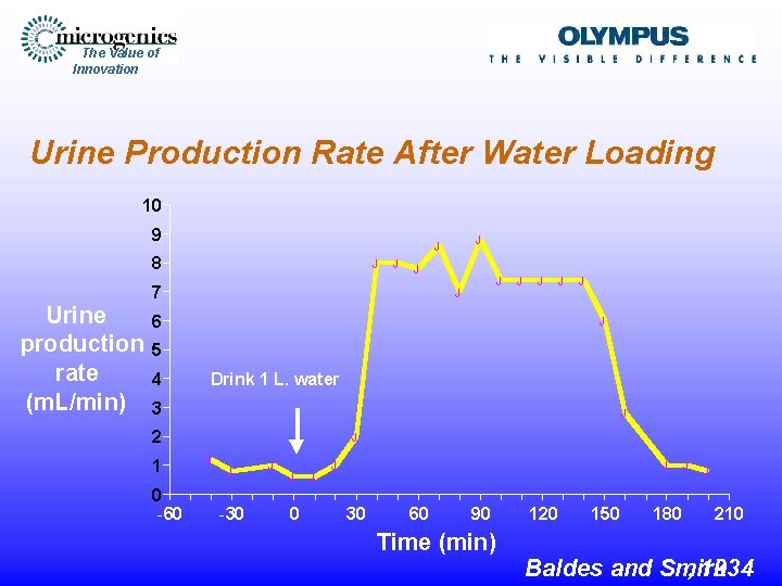 The Value of Innovation Urine Production Rate After Water Loading 10 9 8 Urine