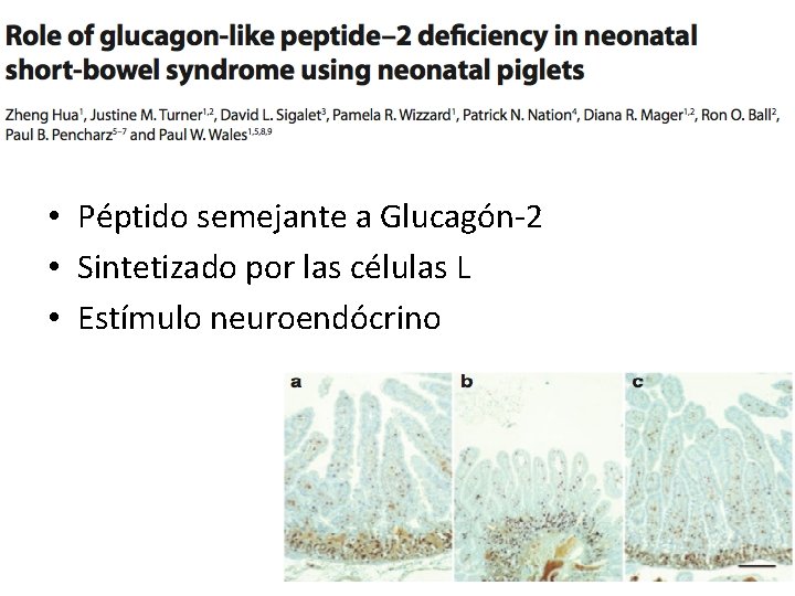 • Péptido semejante a Glucagón-2 • Sintetizado por las células L • Estímulo • Péptido semejante a Glucagón-2 • Sintetizado por las células L • Estímulo