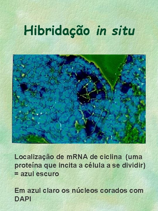 Hibridação in situ Localização de m. RNA de ciclina (uma proteína que incita a Hibridação in situ Localização de m. RNA de ciclina (uma proteína que incita a
