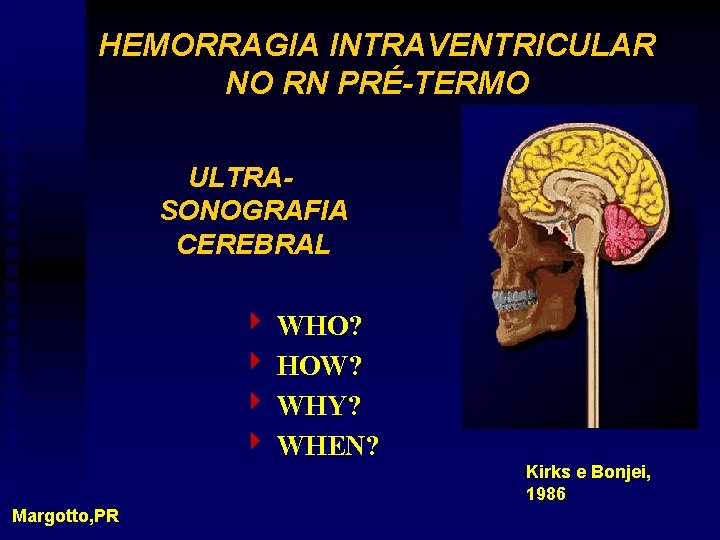 HEMORRAGIA INTRAVENTRICULAR NO RN PRÉ-TERMO ULTRASONOGRAFIA CEREBRAL 4 WHO? 4 HOW? 4 WHY? 4