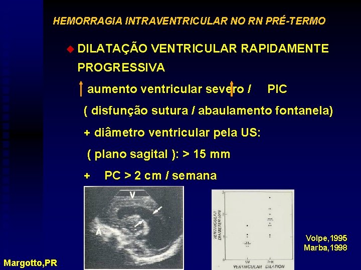 HEMORRAGIA INTRAVENTRICULAR NO RN PRÉ-TERMO u DILATAÇÃO VENTRICULAR RAPIDAMENTE PROGRESSIVA aumento ventricular severo /