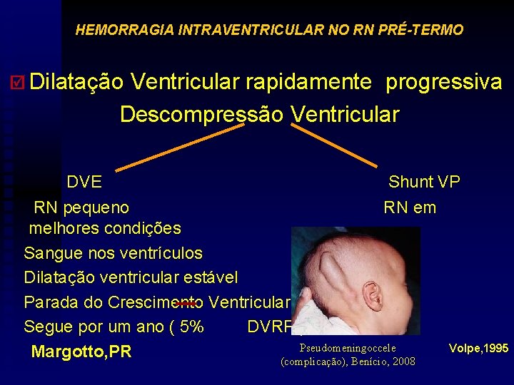 HEMORRAGIA INTRAVENTRICULAR NO RN PRÉ-TERMO þ Dilatação Ventricular rapidamente progressiva Descompressão Ventricular DVE Shunt