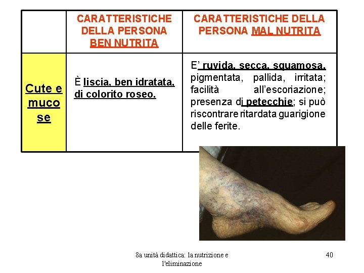 CARATTERISTICHE DELLA PERSONA BEN NUTRITA È liscia, ben idratata, Cute e di colorito roseo.