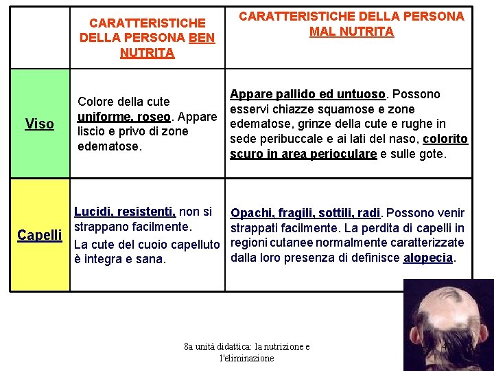 CARATTERISTICHE DELLA PERSONA BEN NUTRITA Viso CARATTERISTICHE DELLA PERSONA MAL NUTRITA Appare pallido ed