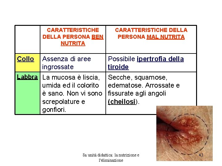 CARATTERISTICHE DELLA PERSONA BEN NUTRITA Collo Assenza di aree ingrossate CARATTERISTICHE DELLA PERSONA MAL