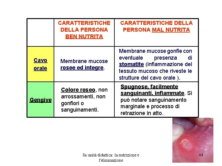 CARATTERISTICHE DELLA PERSONA BEN NUTRITA CARATTERISTICHE DELLA PERSONA MAL NUTRITA Cavo orale Membrane mucose