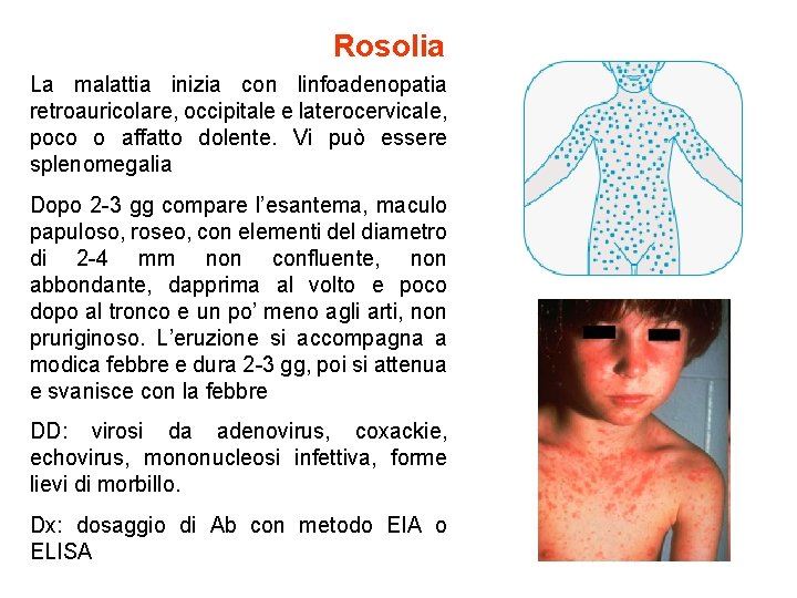 Rosolia La malattia inizia con linfoadenopatia retroauricolare, occipitale e laterocervicale, poco o affatto dolente.