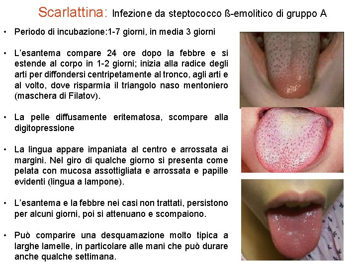 Scarlattina: Infezione da steptococco ß-emolitico di gruppo A • Periodo di incubazione: 1 -7