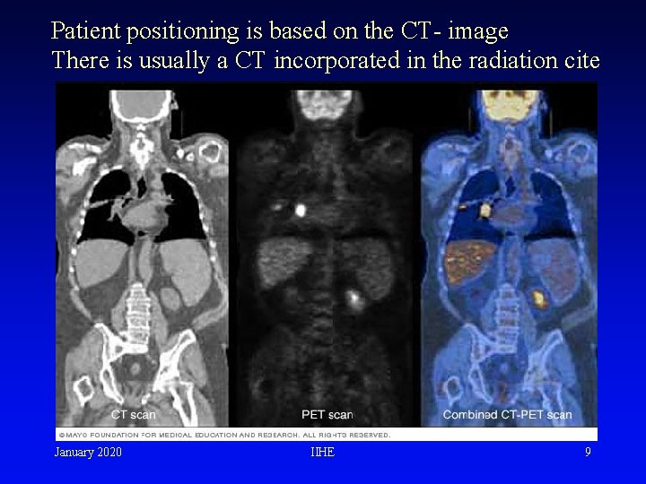 Patient positioning is based on the CT- image There is usually a CT incorporated Patient positioning is based on the CT- image There is usually a CT incorporated