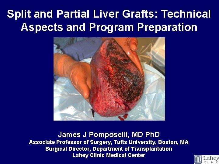 Split and Partial Liver Grafts: Technical Aspects and Program Preparation James J Pomposelli, MD
