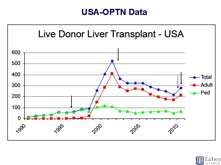 Living Donor Liver Transplantation USA-OPTN Data 