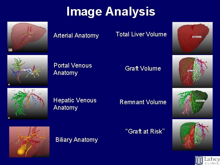 Image Analysis Arterial Anatomy Portal Venous Anatomy Hepatic Venous Anatomy Total Liver Volume Graft