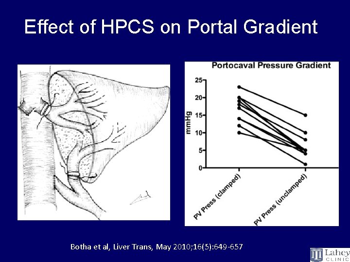 Effect of HPCS on Portal Gradient Botha et al, Liver Trans, May 2010; 16(5):
