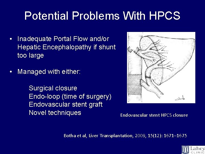 Potential Problems With HPCS • Inadequate Portal Flow and/or Hepatic Encephalopathy if shunt too