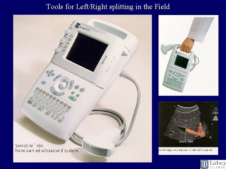 Tools for Left/Right splitting in the Field 