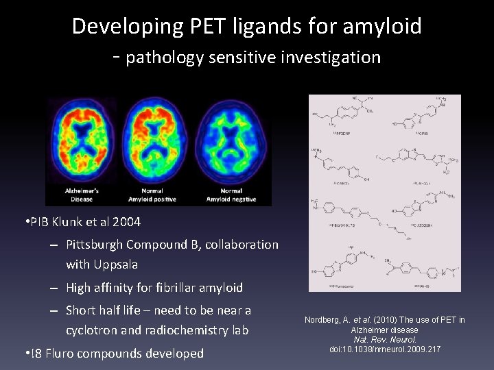Developing PET ligands for amyloid - pathology sensitive investigation • PIB Klunk et al