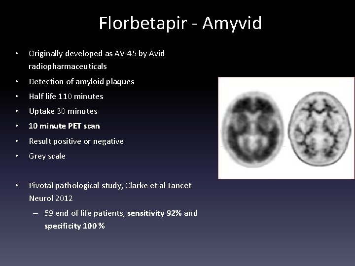 Florbetapir - Amyvid • Originally developed as AV-45 by Avid radiopharmaceuticals • Detection of