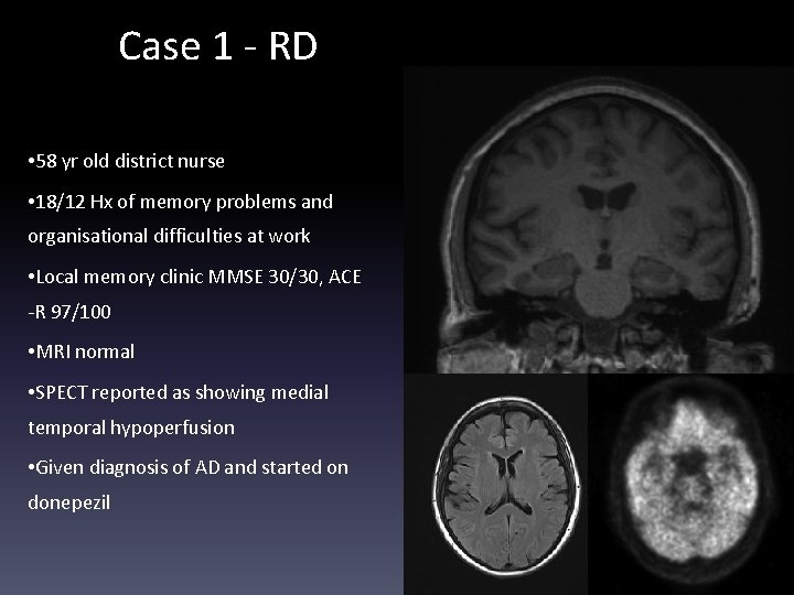 Case 1 - RD • 58 yr old district nurse • 18/12 Hx of