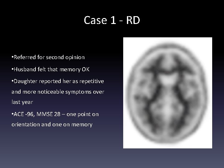 Case 1 - RD • Referred for second opinion • Husband felt that memory