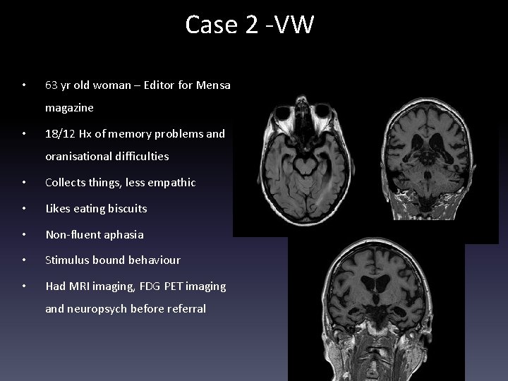 Case 2 -VW • 63 yr old woman – Editor for Mensa magazine •