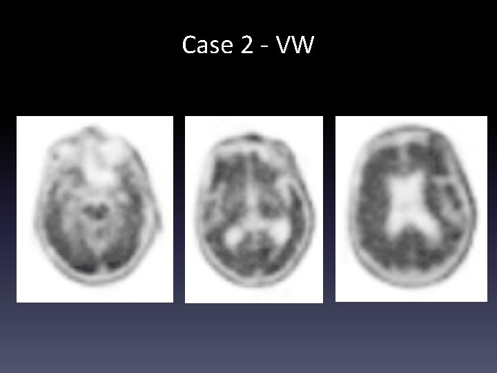 Case 2 - VW 