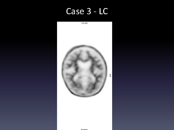Case 3 - LC 