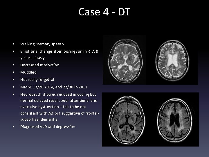 Case 4 - DT • Walking memory speech • Emotional change after loosing son