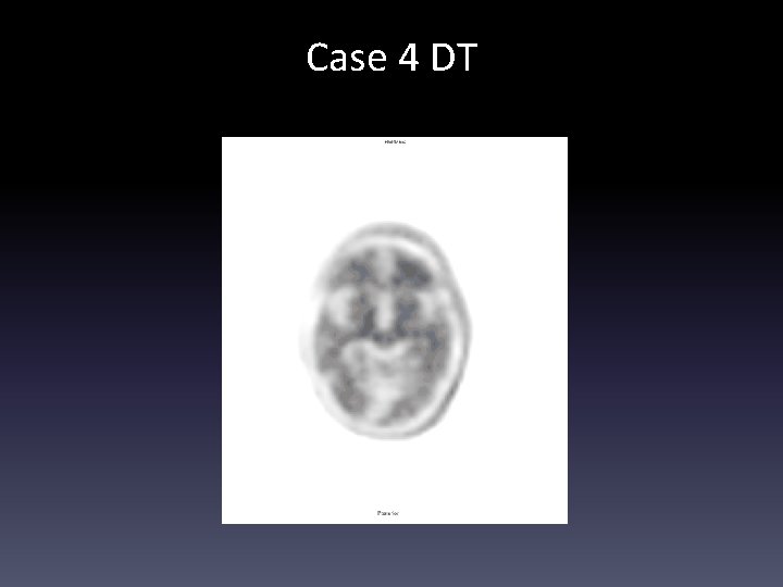 Case 4 DT 