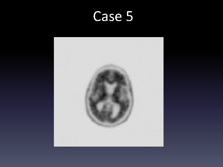 Case 5 