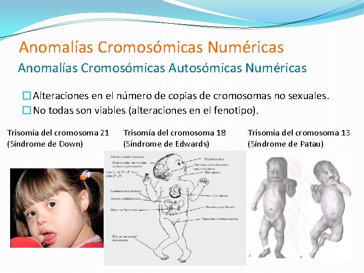 Anomalías Cromosómicas Numéricas Anomalías Cromosómicas Autosómicas Numéricas �Alteraciones en el número de copias de Anomalías Cromosómicas Numéricas Anomalías Cromosómicas Autosómicas Numéricas �Alteraciones en el número de copias de