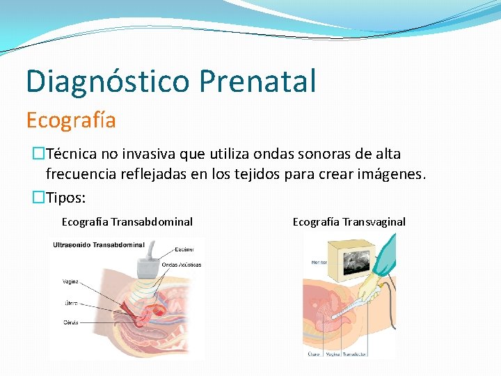 Diagnóstico Prenatal Ecografía �Técnica no invasiva que utiliza ondas sonoras de alta frecuencia reflejadas