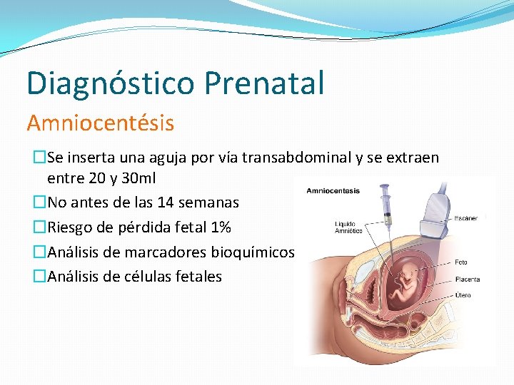 Diagnóstico Prenatal Amniocentésis �Se inserta una aguja por vía transabdominal y se extraen entre