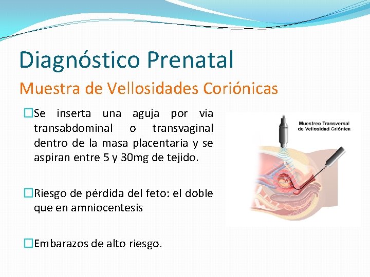 Diagnóstico Prenatal Muestra de Vellosidades Coriónicas �Se inserta una aguja por vía transabdominal o