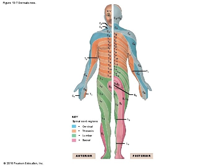 Figure 13 -7 Dermatomes. NV C 2–C 3 C 2 C 3 T 2