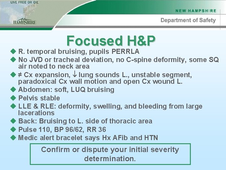 Focused H&P u R. temporal bruising, pupils PERRLA u No JVD or tracheal deviation,