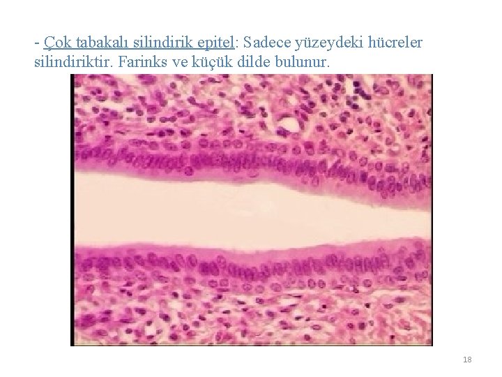 - Çok tabakalı silindirik epitel: Sadece yüzeydeki hücreler silindiriktir. Farinks ve küçük dilde bulunur.