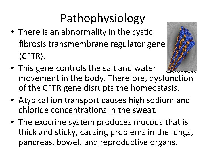 Pathophysiology • There is an abnormality in the cystic fibrosis transmembrane regulator gene (CFTR).