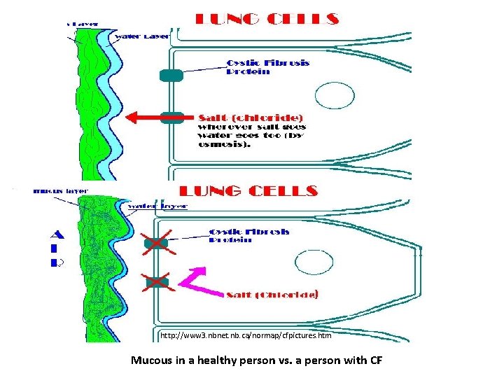 http: //www 3. nbnet. nb. ca/normap/cfpictures. htm Mucous in a healthy person vs. a