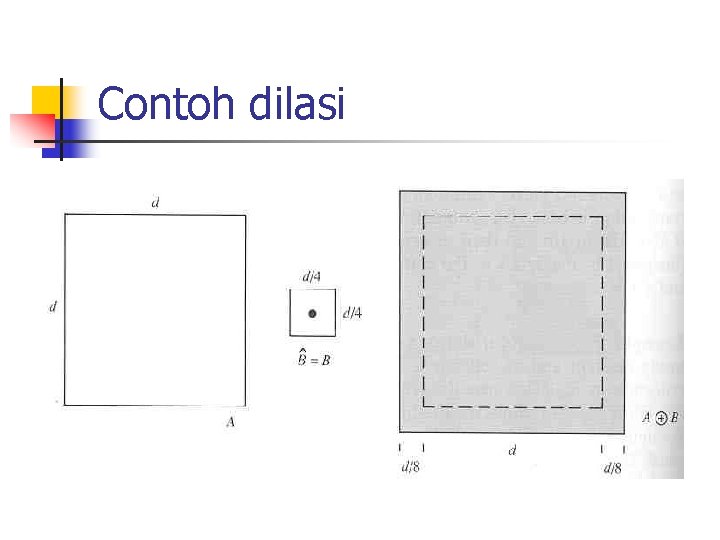 Contoh dilasi 
