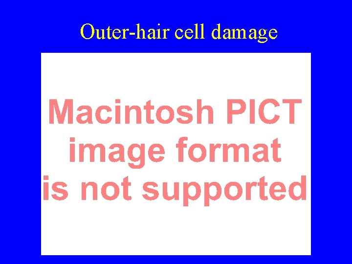 Outer-hair cell damage 