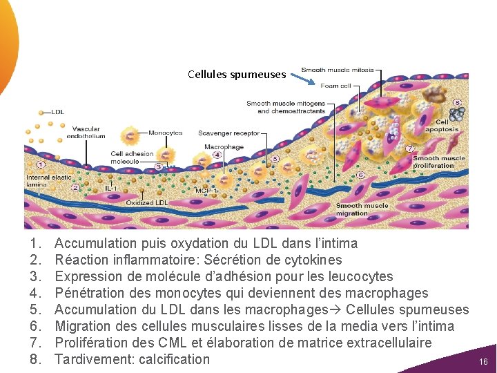 Cellules spumeuses 1. 2. 3. 4. 5. 6. 7. 8. Accumulation puis oxydation du